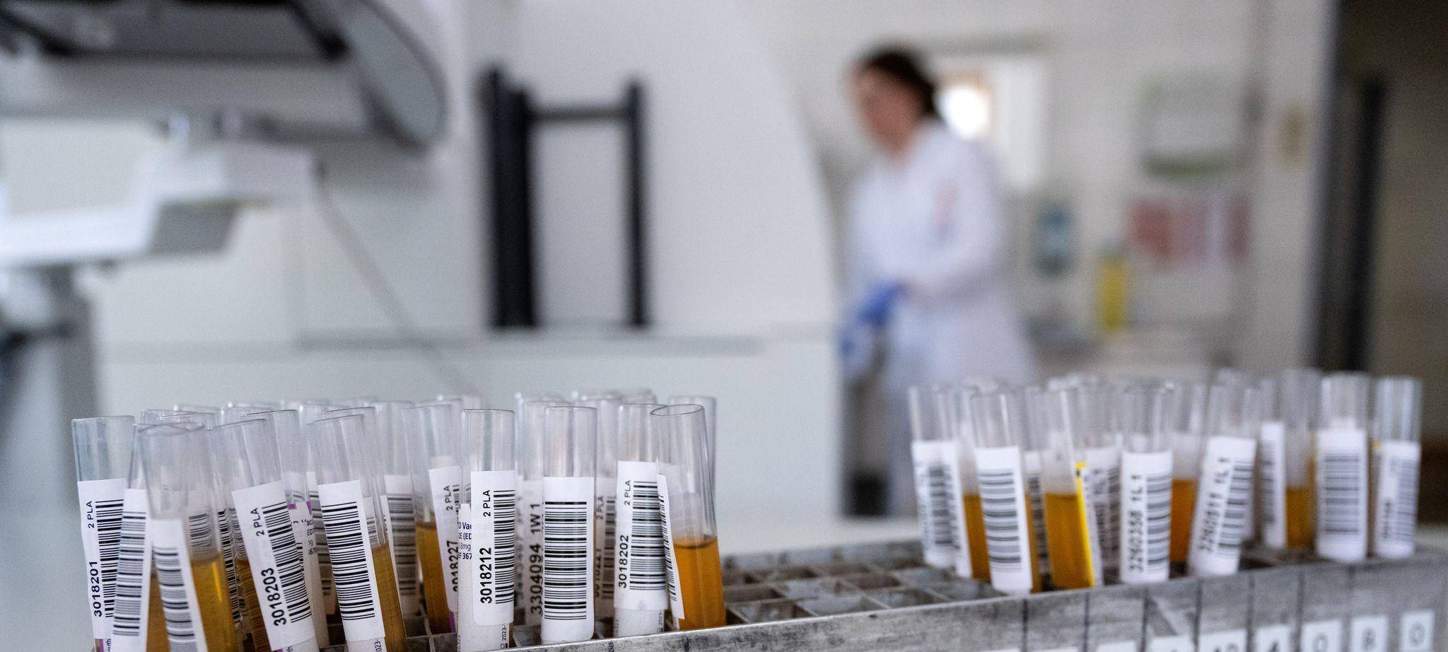 Teströhrchen mit Blutproben in einem Labor